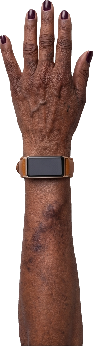 A resident’s arm wearing the Clarity device